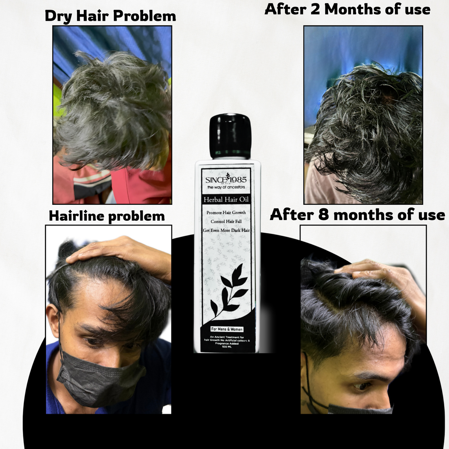 SINCE 1985 Herbal Hair Oil | 100%Natural
