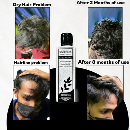 SINCE 1985 Herbal Hair Oil | 100%Natural